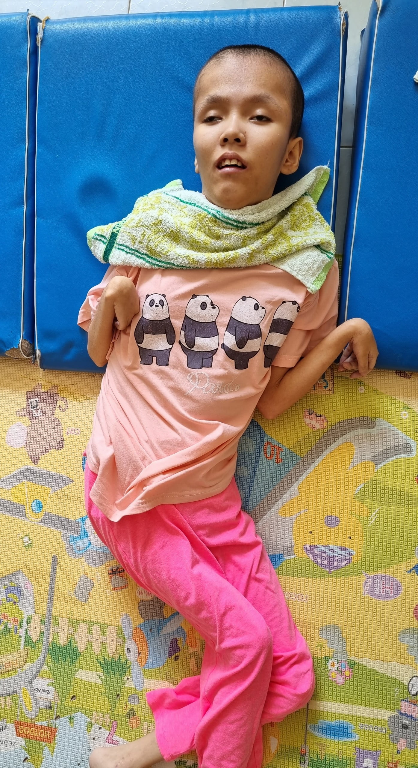 Nguyen Thi Bich Mai - She has cerebral palsy and hydrocephalus. Baby born date: June 3, 2004