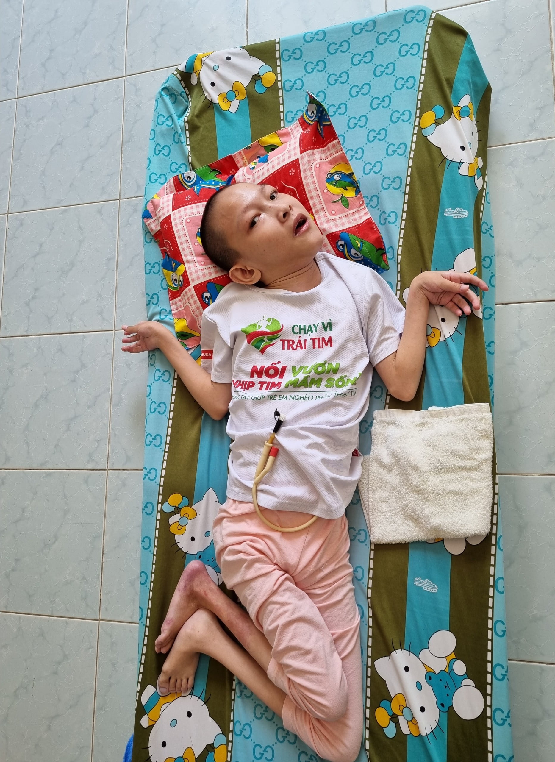 Nguyen Thi Thuy Linh - Baby has cerebral palsy and epilepsy